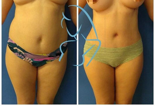 Slider image (5) Dr. Xavier Toscano - Plastic Surgeon